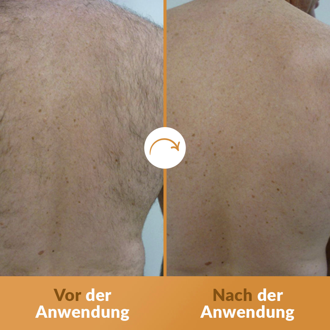 Gentleman IPL Pro™ + Gratis Premium Trimmer